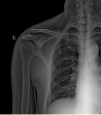 【改善就医体验 打造更有温度的医院】您了解吗，武汉大学中南医院嘉鱼医院已开展的这些新技术新项目（六）
